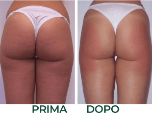 c_prima_dopo_onde_durto.x80643