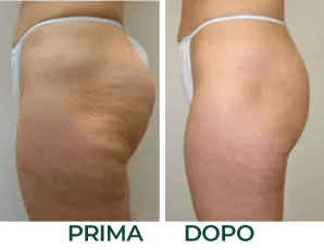 d_prima_dopo_onde_durto.x80643